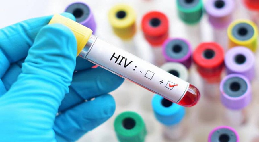 HIV