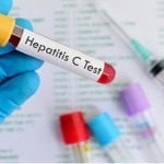 Hepatitis C