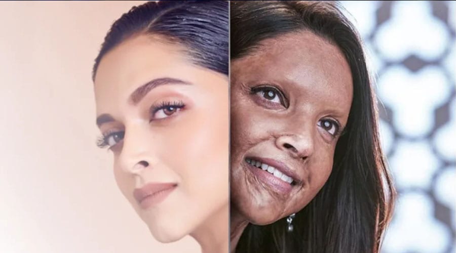 Chhapaak film