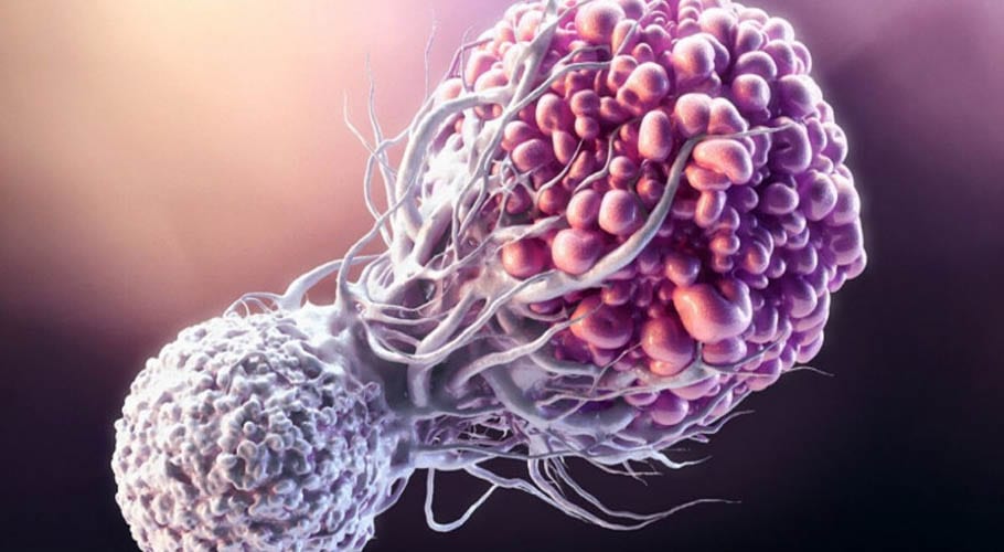 World Cancer Day: Free treatment of cancer in Pakistan