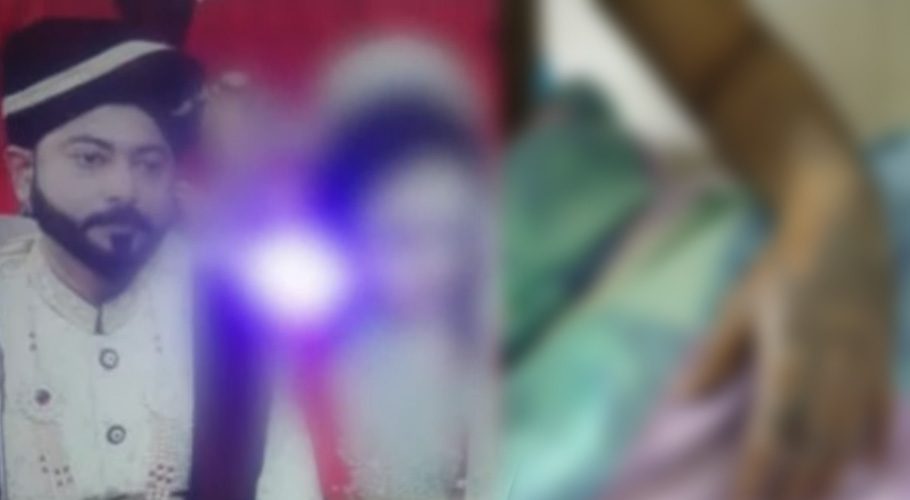 It may be recalled that earlier in a quarrel in Liaqatabad, a neighbour threw acid on the sacrificial animal