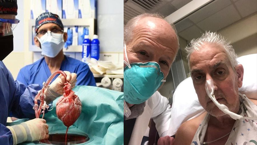 The surgery was among the first to demonstrate the feasibility of a pig-to-human heart transplant. Source: BBC.