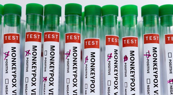 Italy kicks off vaccination campaign against monkeypox