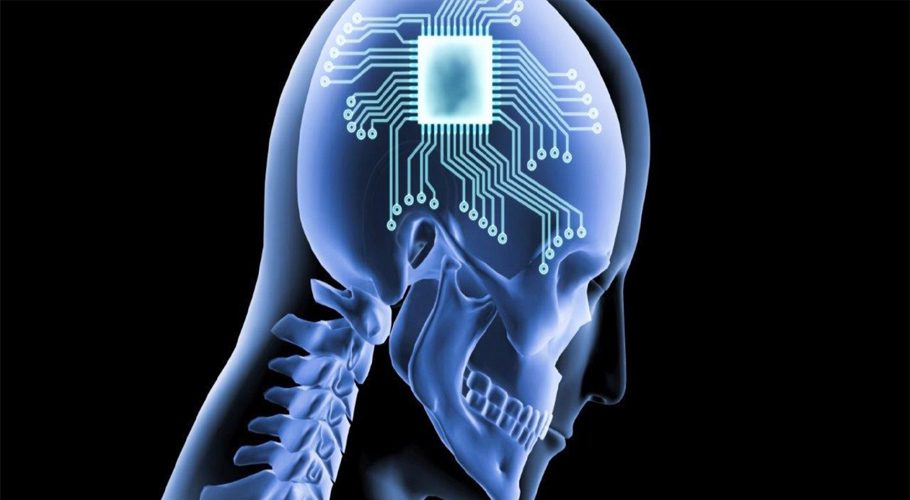 Once implanted, the device would purportedly allow the brain to wirelessly interface with a computer, Musk said (Illustration)