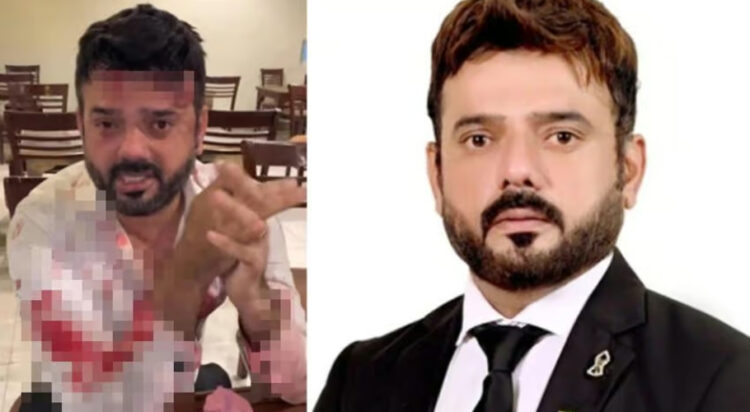 Karachi Bar Association President Aamir Nawaz Warraich sustained injuries following an attack by six individuals on Tuesday night (Image: Daily Pakistan)