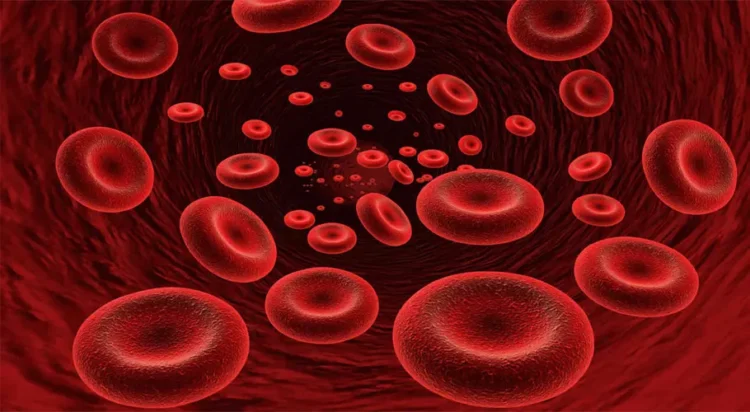 Anemia