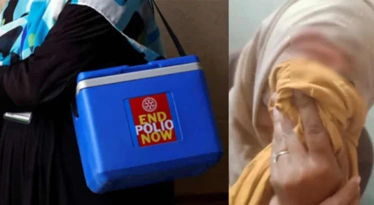 Polio